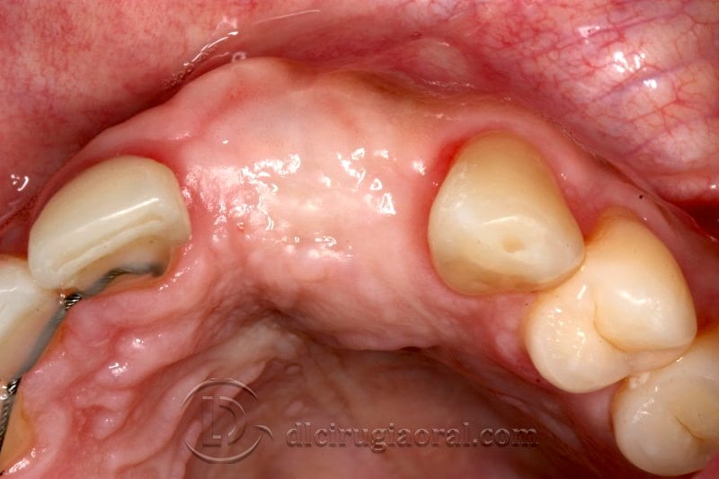 Occlusal view