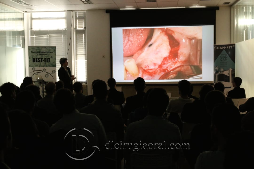 Bone Atrophies Talk in Porto