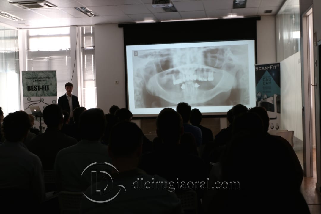 Bone Atrophies Talk in Porto