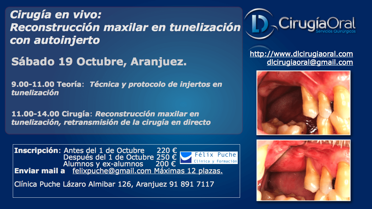 19th October – Course in maxillary reconstruction through tunnel approach