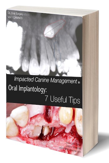 eBook: Impacted Canine Management:  Oral Implantology, 7 Useful Tips